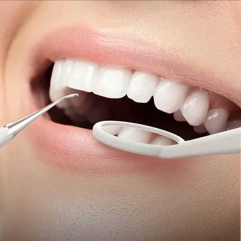 Profesionálne príslušenstvo na čistenie zubného povlaku je súčasťou balenia
